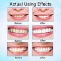 Miniatyrbild 3 av 4: White Tooth Cleaning Pen Whitening Treatments Gel Pennor Tänder White Solution 2st rt153