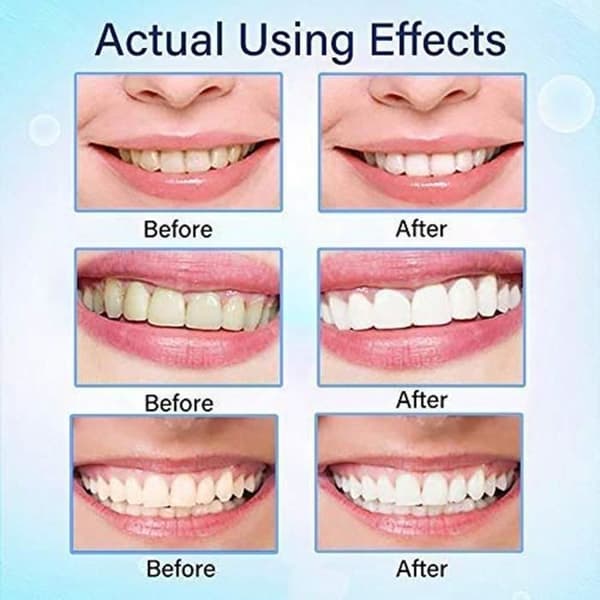 White Tooth Cleaning Pen Whitening Treatments Gel Pennor Tänder White Solution 2st rt153