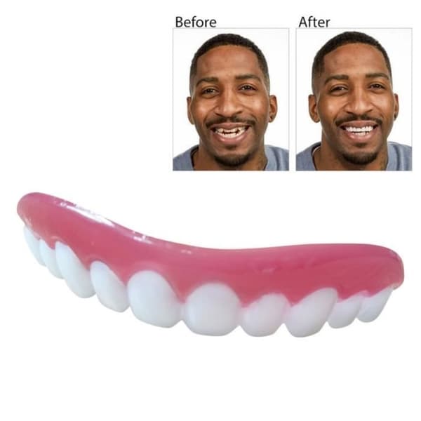 Perfect Smile Faner Professionell Dub finns i lager för tandkorrigering för dåliga tänder Perfect Smile Faner