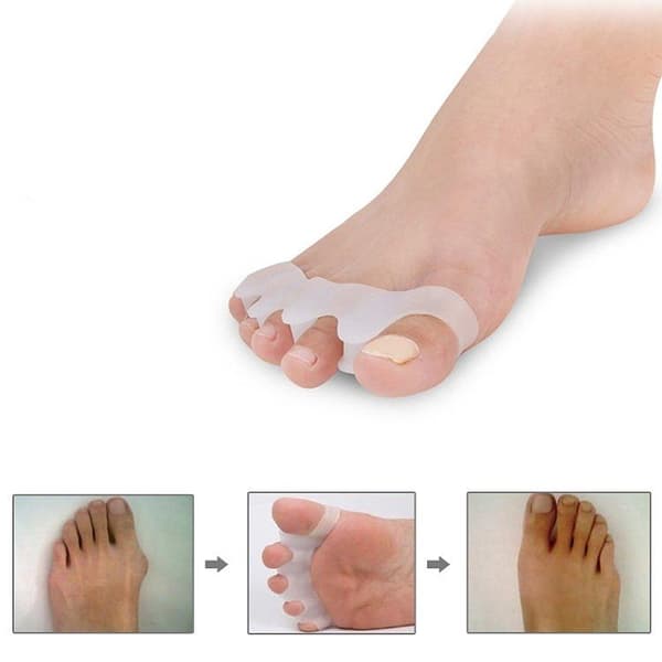 Hallux Valgus Varvaslevitin / Erottaa Varpaat – Tuki