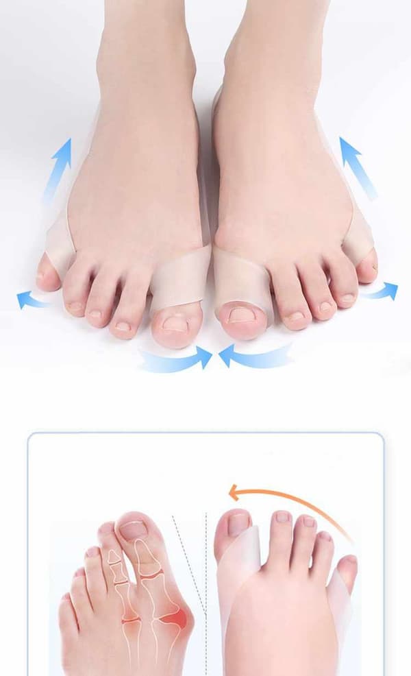 Hallux Valgus - Støtteskinne til storetå/lilletå - 2 pakker