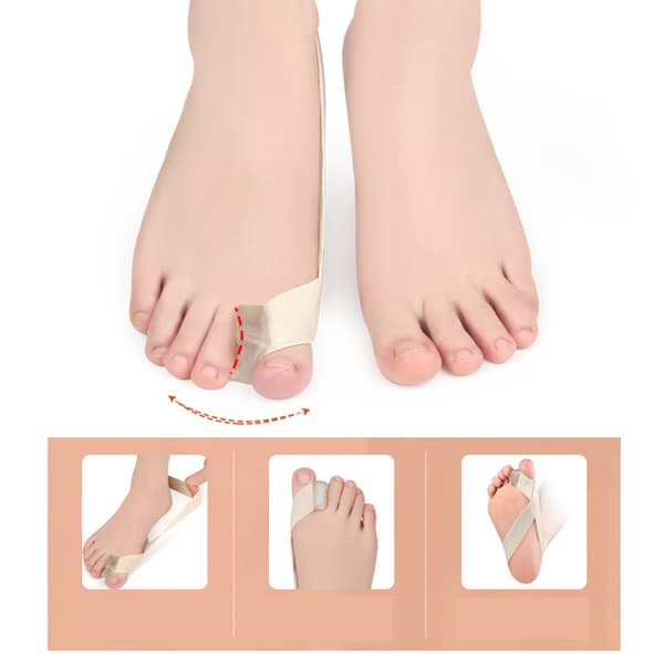Hallux valgus bunion corrector tåavskiljare