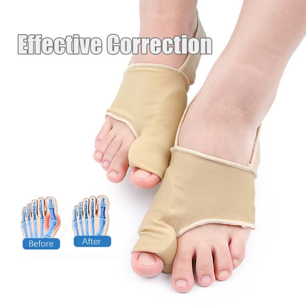 INF Hallux valgus corrector, överlappande tåavskiljare 2-par