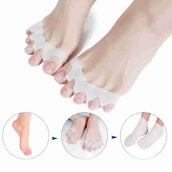 Hallux Valgus - viisi varvasta pitkä
