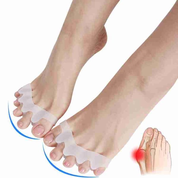 Hallux Valgus - viisi varvasta pitkä