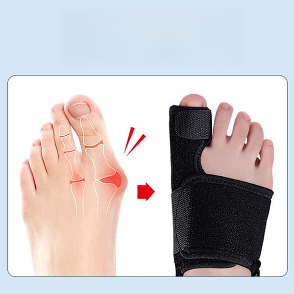 INF Hallux Toe Valgus Skinnebandagekorrektion 1-par