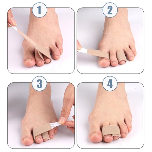 INF Skin Tone Toe Splinter til Claw Toe - 20 stk 0