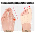 Miniatyrbilde 2 av 11: INF Bunion Corrector for Hallux Valgus, Justerbar Tårettetang 0