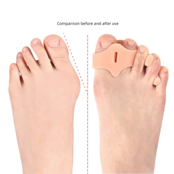 INF Transparent Tåseparator med Dubbla Hål för Hallux Valgus Korrigering