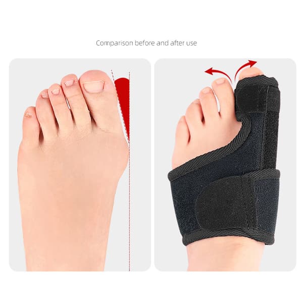 INF Tommelkorrigerer for lindring av bunion