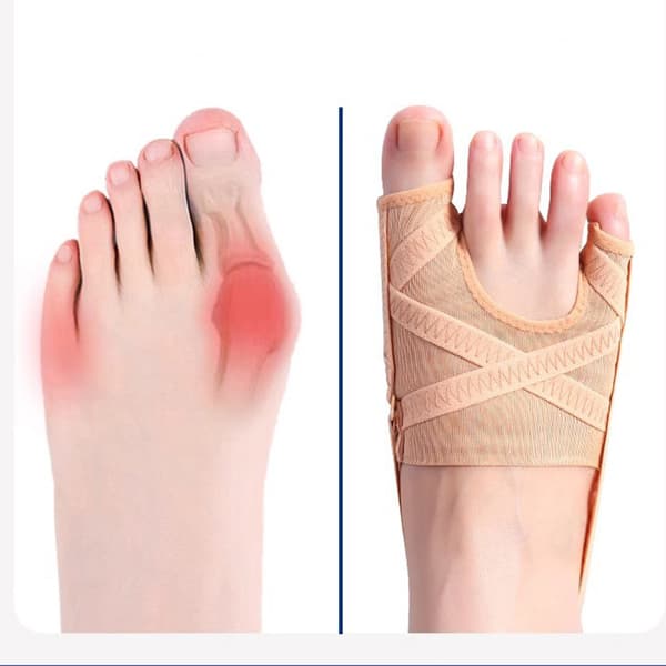 INF Pustende dobbelt tåskille for hallux valgus og overlappende tær