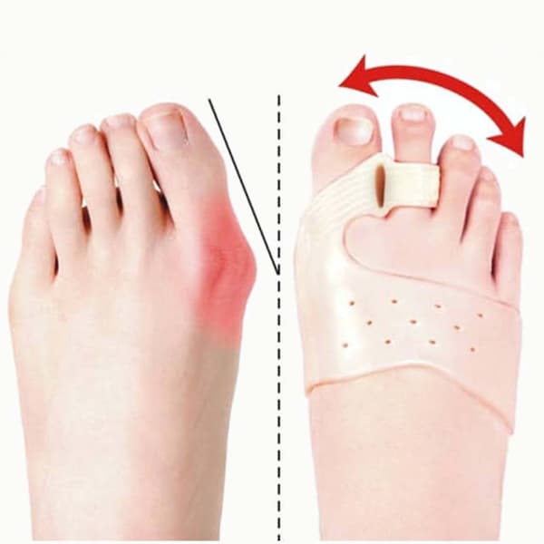 2-Pack Hallux Valgus Tåseparerare Gel