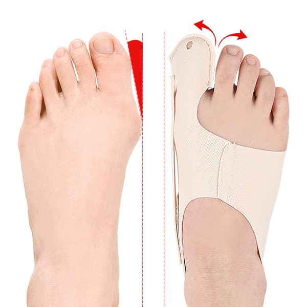 INF Vaivasenluun korjaaja varpaanoikaisija Hallux Valgus -oireiden lievitykseen