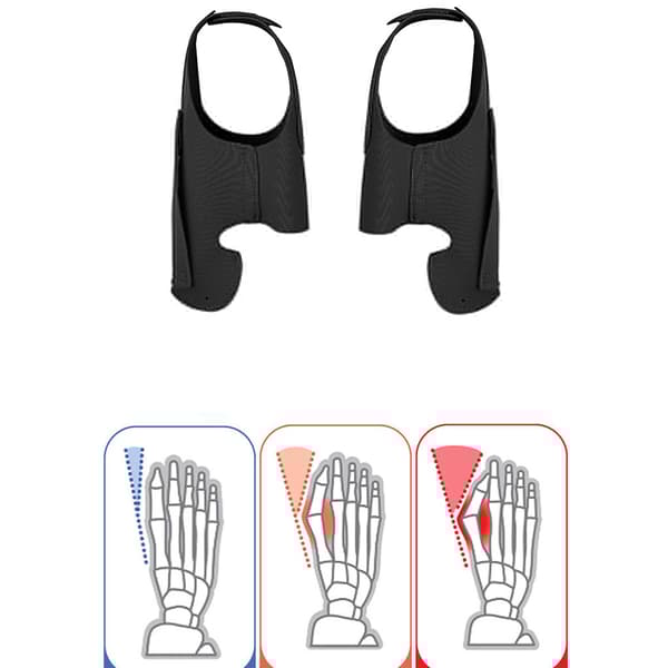 INF 017 Bunion Corrector Foot Sleeve - Beige L Størrelse (Venstre+Højre)