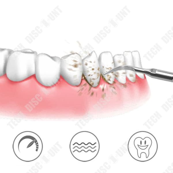 TD® Ultrasonic Tooth Cleaner Anti-Tand- och Anti-Stain KitSmart Anti-Tartar och Anti-Fläck Tandrengöringssats