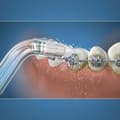 Miniatyrbild 2 av 3: Tandborsthuvud Waterpik OD-100E