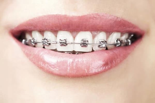 ORTHO SALVIA DENTAL ortodontisk tandkräm 75 ml