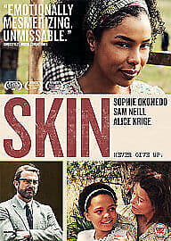 Skin DVD (2009) Sophie Okonedo, Fabian (DIR) Cert 12 Pre-Owned Region 2