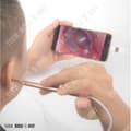 Miniatyrbild 3 av 4: TD® otoscope pro medicinsk pediatrisk barn LED USB endoskop kamera nät vattentät remover visuella öronstick rengöringsverktyg