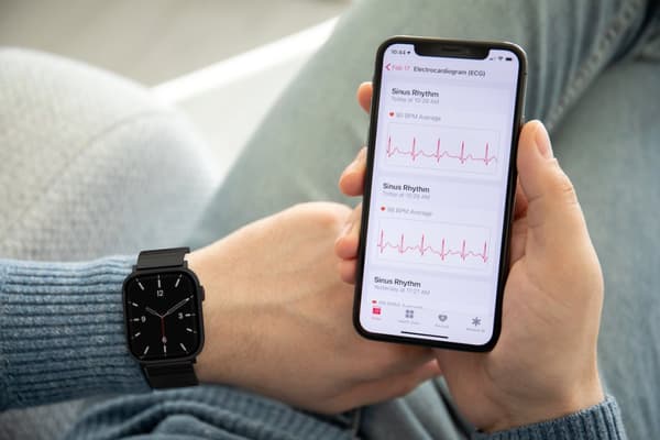 Remarmbånd til Apple Watch ULTRA SE 9 8 7 6 5 4 3 2 1 45mm 44mm 42mm